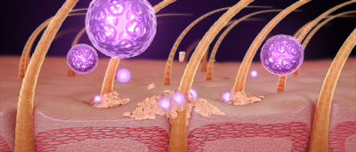 Retin-A  | Illustration by LFC-RX a Bay Area Medical Production Studio